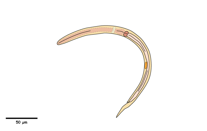 Crenosoma vulpis larva