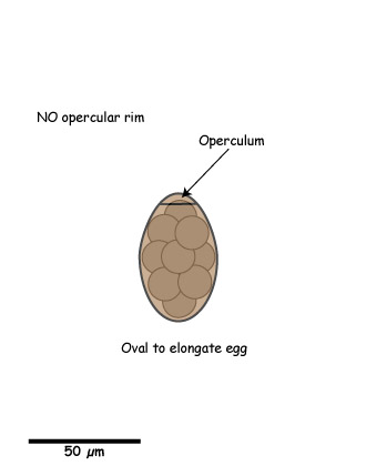 Spirometra egg