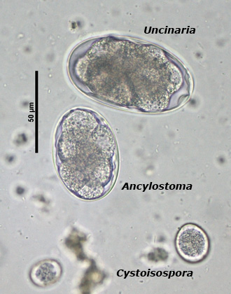 Ancylostoma egg