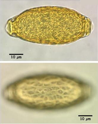 Capillaria plica egg