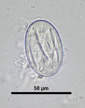 Physaloptera egg