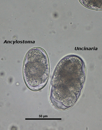 Uncinaria egg