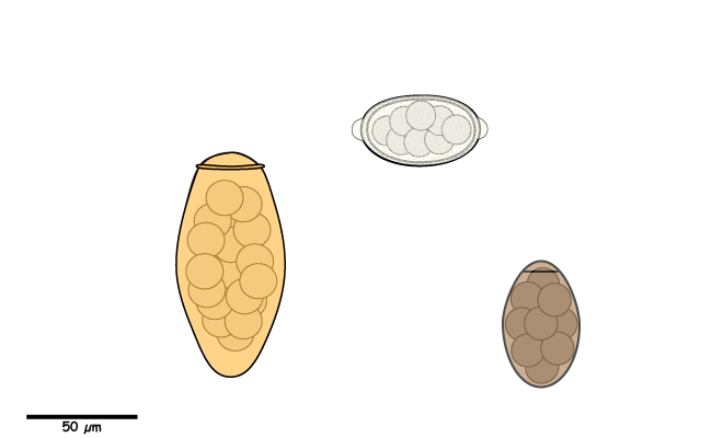 Egg with a single operculum or with bi-polar plugs