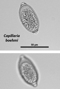 Capillaria boehmi egg