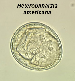 Heterobilhazia americana egg
