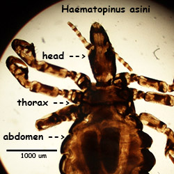 Haematopinus asini head & thorax