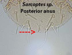 Sarcoptes anus