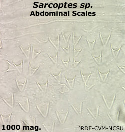 Sarcoptes scales