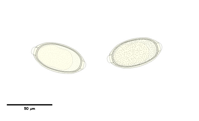 Egg with bi-polar plugs and pitted shell surface.