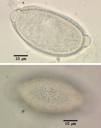 Capillaria aerophilus egg