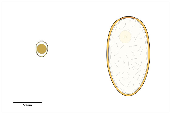 Egg or oocyst with single operculum or micropyle & polar-cap, respectively.