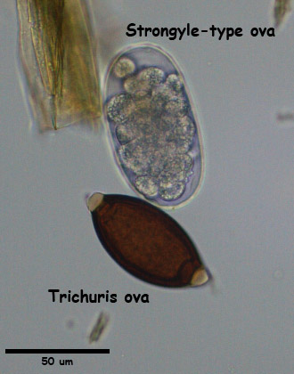 trichuris egg