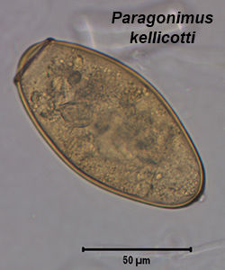 Paragonimus kellicotti egg