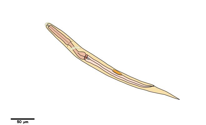 Large Nematode Larva with distinct rhabditiform esophagus.