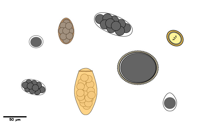 Eggs or oocysts without bi-polar plugs.