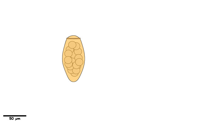 Large yellow to brown egg approx. 90µm long, with a distinct rim around the operculum.