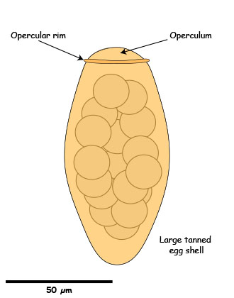 Paragonimus egg