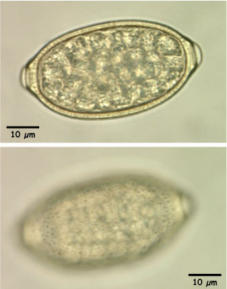 Capillaria egg