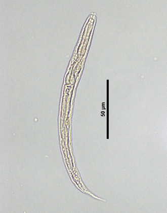 Strongyloides stercoralis larva