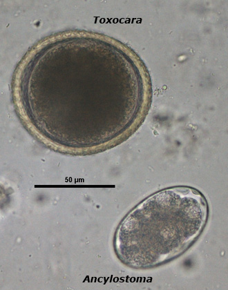 Toxocara egg