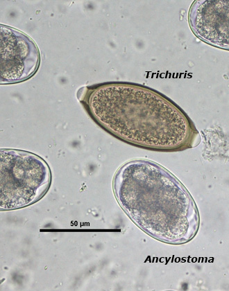 Trichuris egg