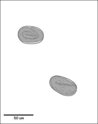 strongyloides egg