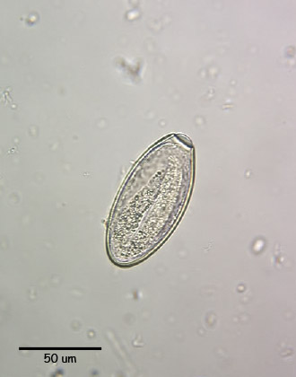 oxyuris egg