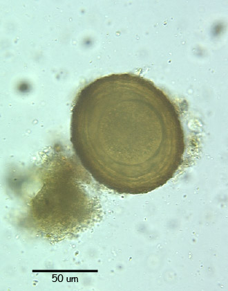 parascaris egg