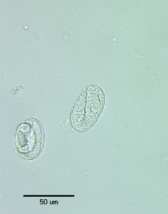 strongyloides egg