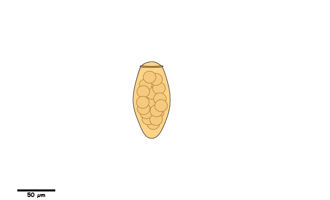 Large yellow to brown egg approx. 90um long, with a distinct rim around the operculum.