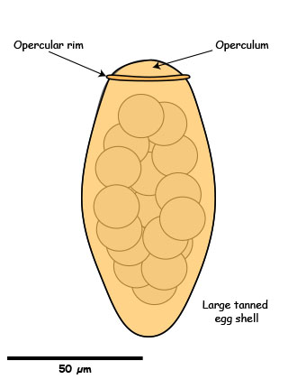 Paragonimus egg