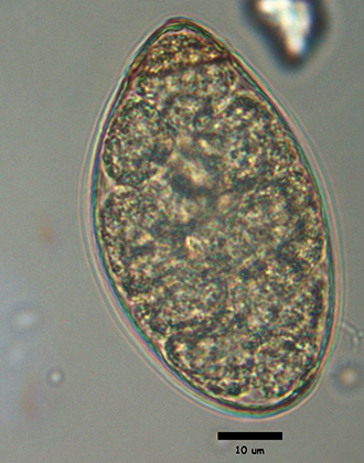 Spirometra egg