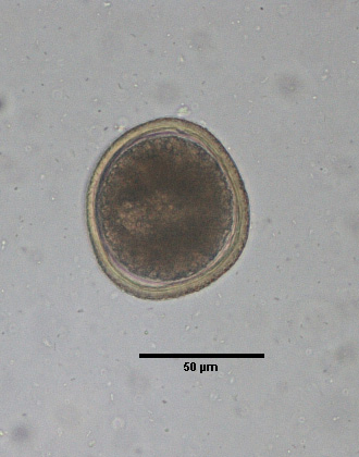 Toxocara egg