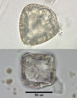 Moniezia egg