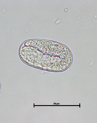 strongyloides egg