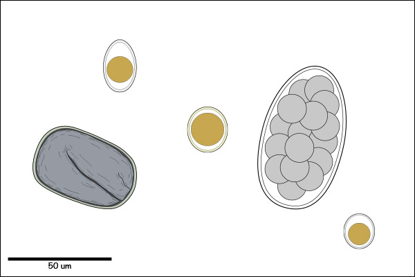 Egg / oocyst withOUT bi-polar plugs.