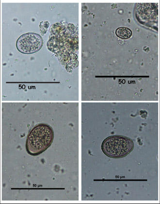 Eimeria Oocyst