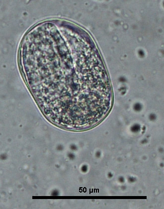 strongyloides egg