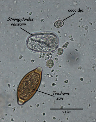 trichuris egg