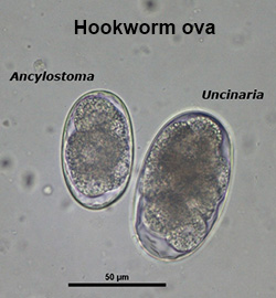Hookworm egg