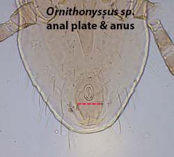Ornithonyssus anus location