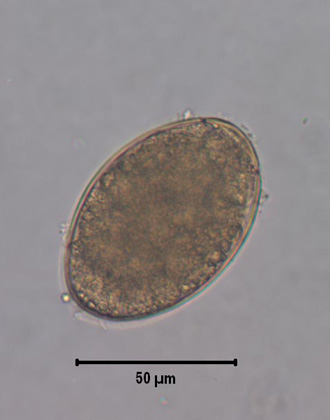 Spirometra egg