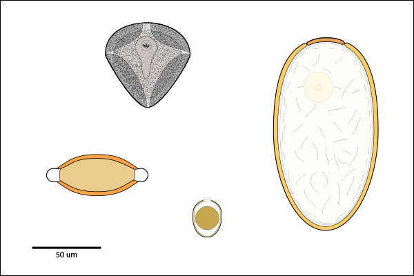 Ornate egg or oocyst:  with operculum, micropyle & polar-cap, bipolar plugs or rough grainy shell.
