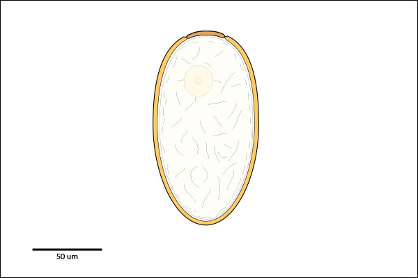 Large egg: Greater than 120 um long. Multi-celled Embryo. Operculum is sometimes difficult to observe.