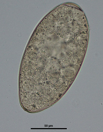 fasciola egg